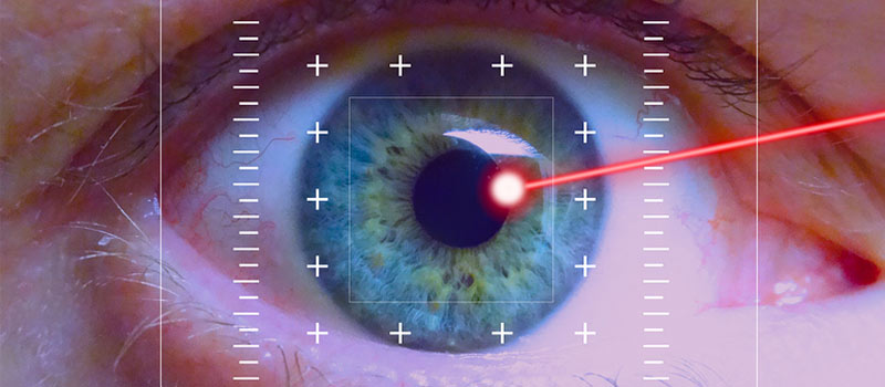 Trabeculoplastia láser selectiva (SLT), cirugía láser para el glaucoma