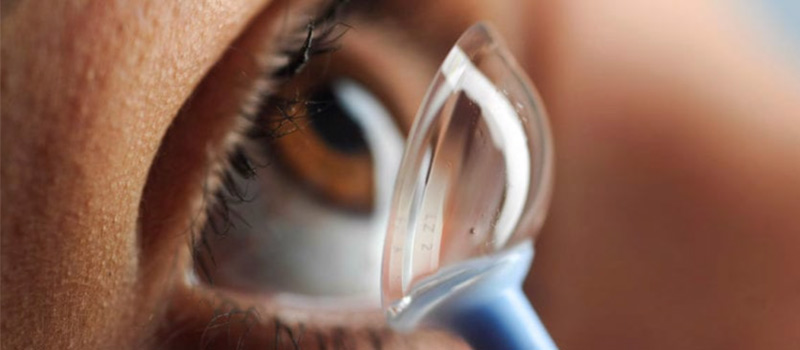 Qué son las lentes de contacto esclerales y quiénes pueden usarlas
